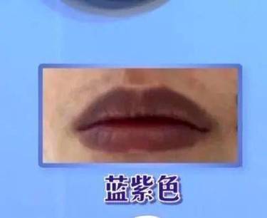 嘴唇变蓝是什么原因