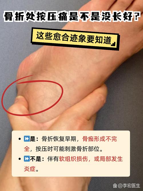 骨折是按压疼还是一直疼图标