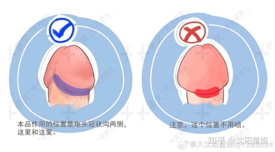 延时喷剂的正确使用方法图标