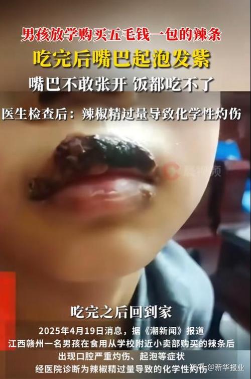 上嘴唇污的是什么原因