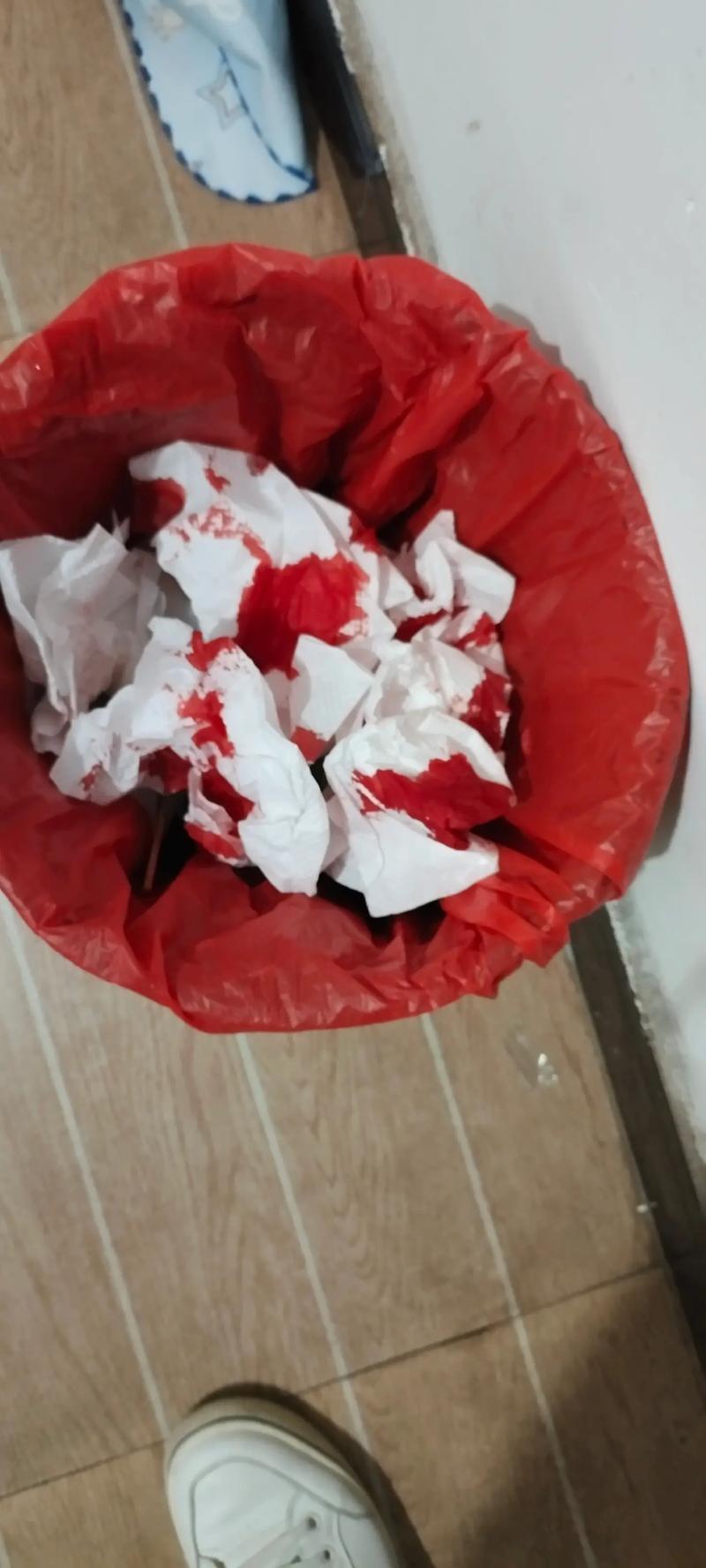 超级朋友圈流鼻血版本