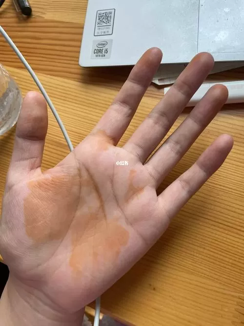 手变黄了是怎么回事图标