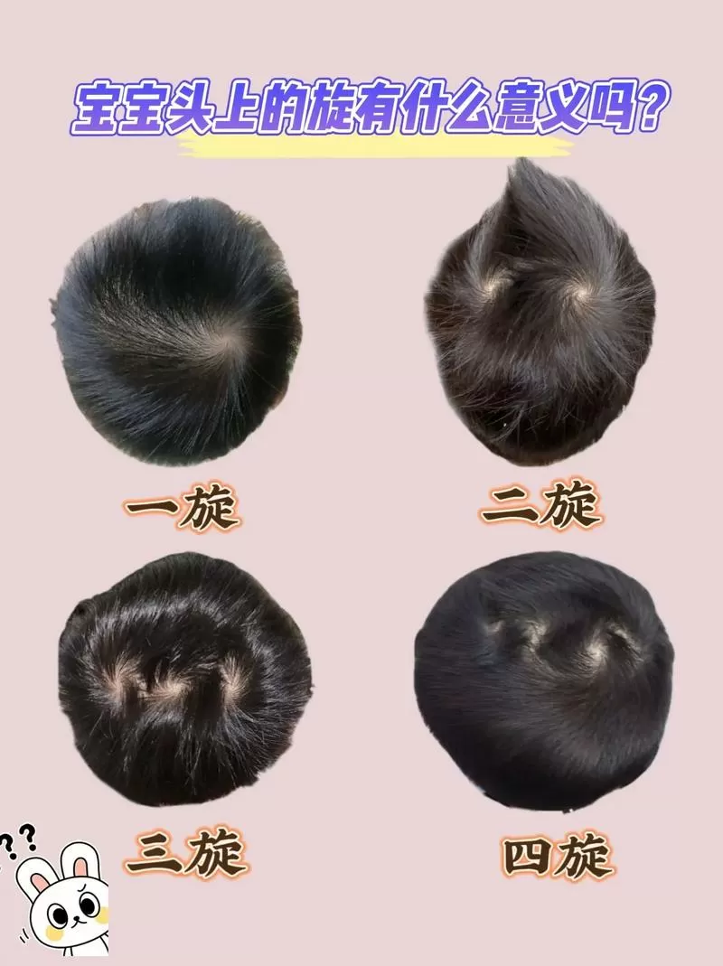 孩子头上的旋代表什么图标