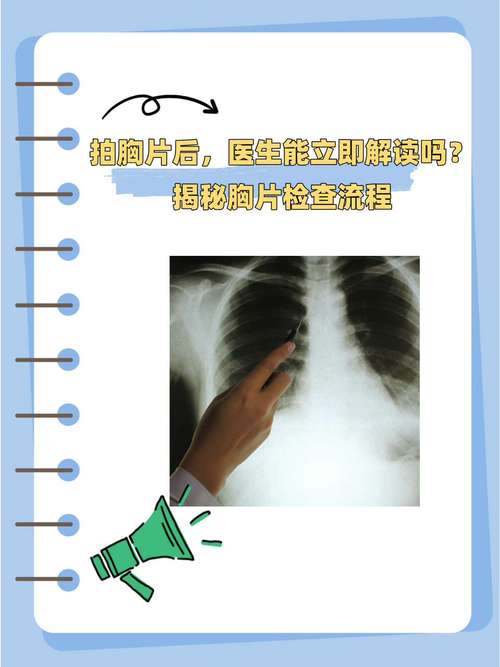 100胸片曝光率软件加速永久