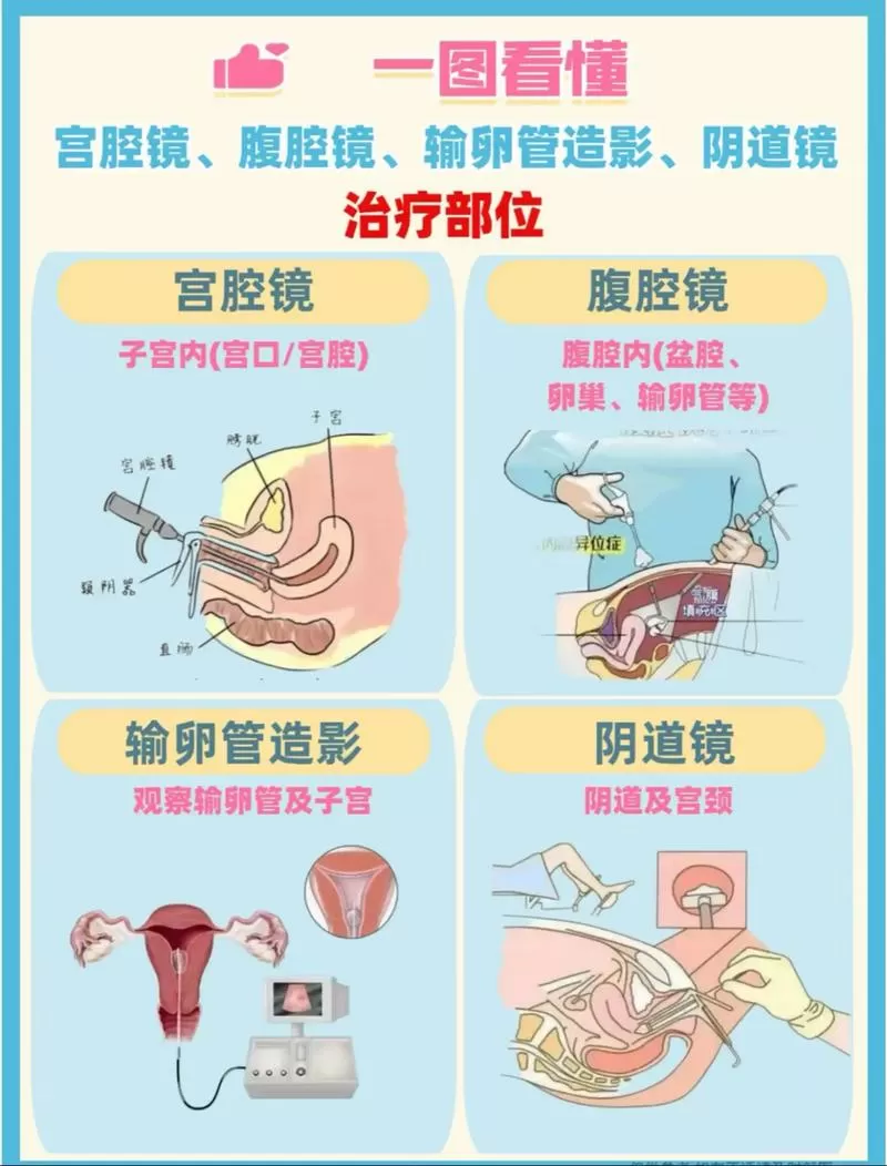 宫腔镜跟腹腔镜哪个疼图标