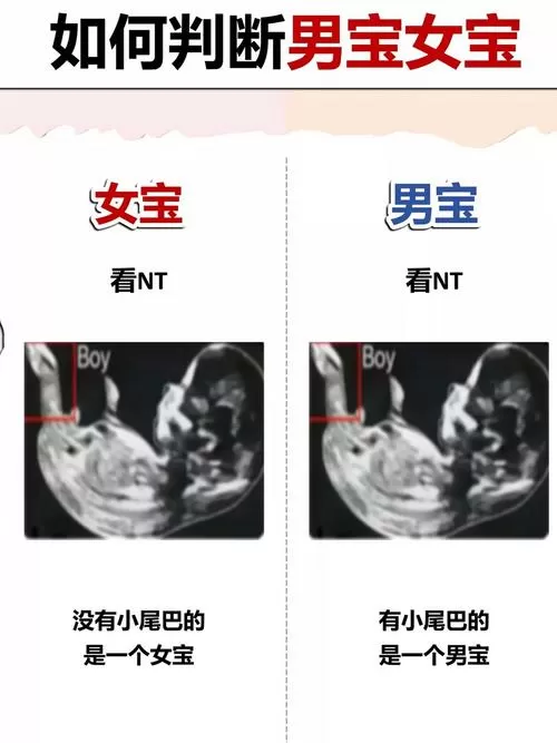 怀孕12周男女区别