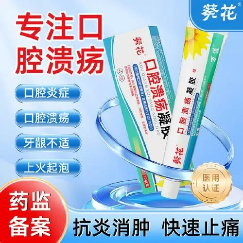 口腔溃疡10个小偏方图标