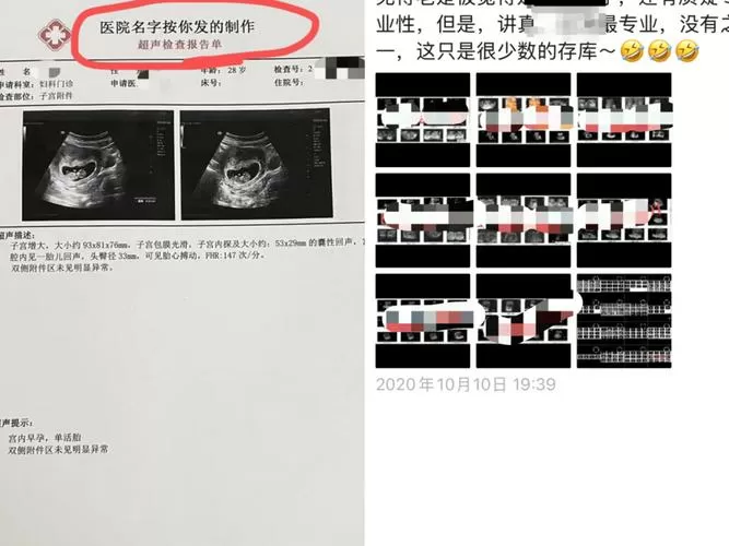 b超单怎么看图标